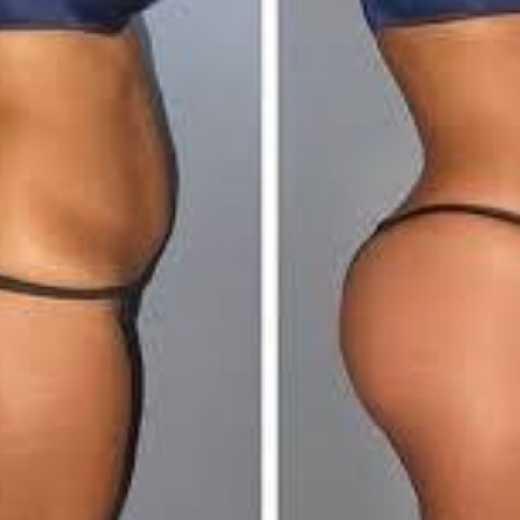 HIPS AND BUMS ENLARGEMENT CREAM AND PILLS +27605775963